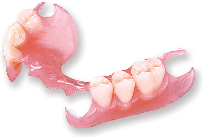 Prothèse Dentaire Amovible