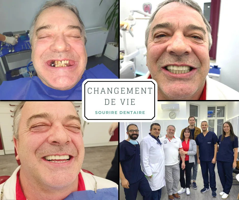 implant basal témoignage