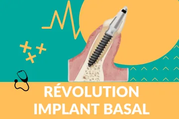 révolution implant basal