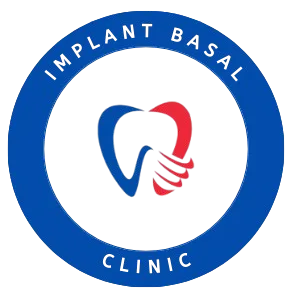 ImplantBasal.fr